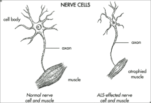 als diagram motor neurons.gif